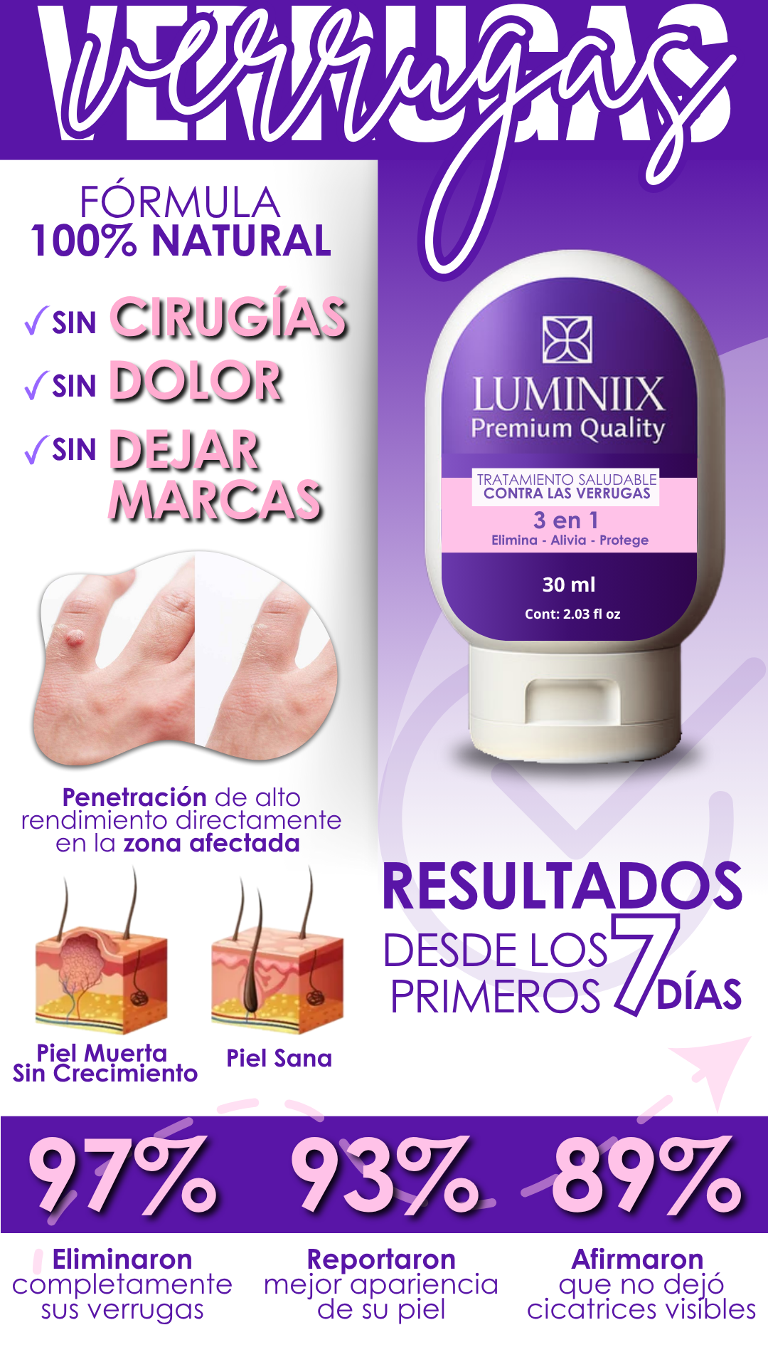 Resultados de Luminiix